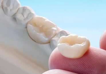 Porcelain Crowns