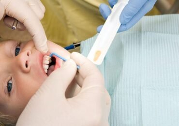 Fluoride Treatment ​
